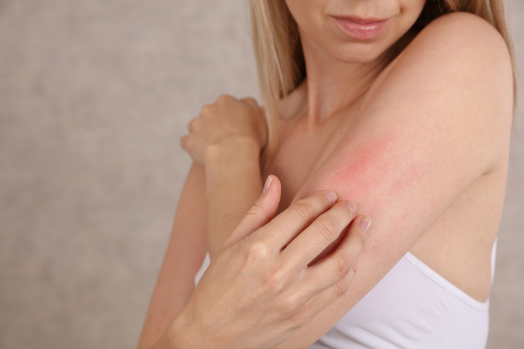 Αλλεργία: Πώς θα ανακουφιστώ από τα ενοχλητικά συμπτώματα;