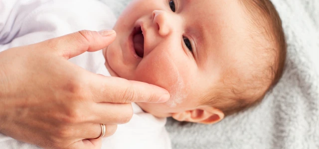 Ατοπική Δερματίτiδα σε βρέφη: 6+1 tips για να ανακουφίσουμε άμεσα το  δερματάκι του μωρού